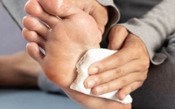 Veza između znojenja i gljivičnih problema stopala